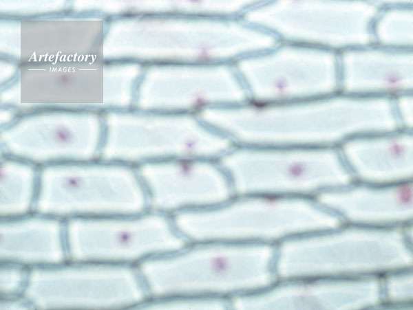 ﾀﾏﾈｷﾞ鱗茎内側表皮細胞 酢酸ｵﾙｾｲﾝ染色